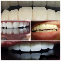 خدمات دندانپزشکی  و دندانسازی مستر دنت (اقساط)|خدمات آرایشگری و زیبایی|ارومیه, |دیوار
