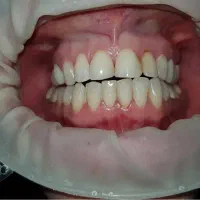 دستیار دندانپزشک خانم