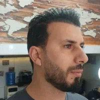 کاشت مو و ابرو تضمینی