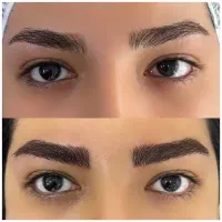 خدمات میکروبلیدینگ فیبروز شیدینگ لب بنمژه ریموو