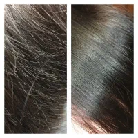 پکیج درمانی مو با موخوره گیری