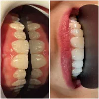 دندانپزشکی اقساط ۲۰ ماهه