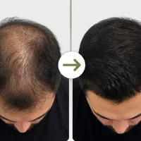 بدون عوارض و تضمینی مودربیار