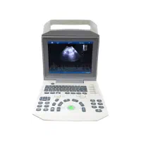 سونوگرافی zonecare i50