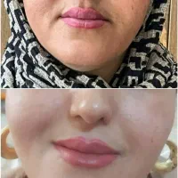 رضایت درمانجوی عزیزمون خانوم اچیکزی از پک کامل