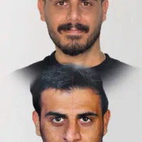 عمل بینی فقط با پرداخت ۳۶ میلیون