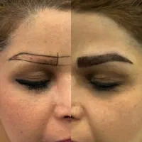 جشنواره کاشت ابرو با موی بلند دکتر وفایی