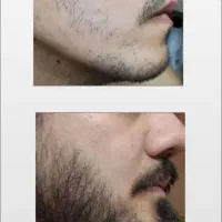 دیگه کوسه نباش