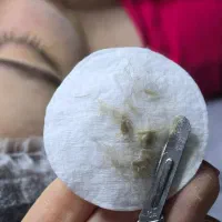 اصلاح صورت با درماپلینگ پاکسازی و فشیال