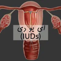 مطب مامایی