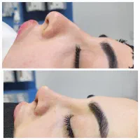 عمل بینی ۴۹ تومن