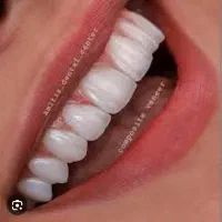 استخدام پودر گذار لابراتوار
