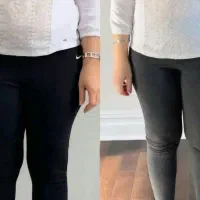لاغری و کاهش وزن واقعی با روش نوین در مطب