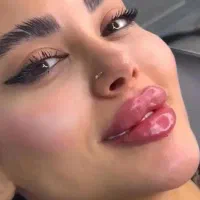 خدمات تخصصی فیلر و بوتاکس