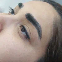 میکروبلیدینگ نانو اولین بار در شوشتر