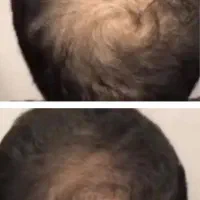 با همراهی با من پرپشتی موهات تضمینیه