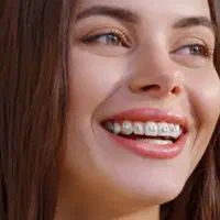 لبخندت رو بساز ، ارتودنسی اقساطی
