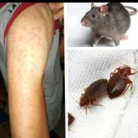 سمپاشی ساس سوسک موش کنه(سم پاشی)کل نقاط وحومه