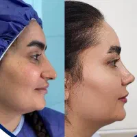 تخفیف ویژه زیبایی