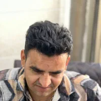 کاشت مو شیرازی، قسطی