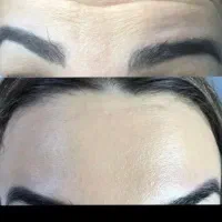 کیلینیک زیبایی بانوان در خمینی شهر وجوی آباد