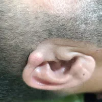 خدمات جراحی سرپایی