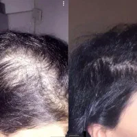 شروع دوباره