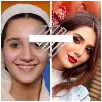 جراحی بینی لیپوساکشن ابدو پیکرتراشی اسلیو قسطی