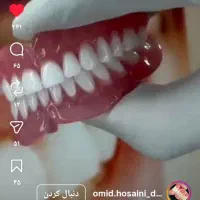 دست دندان متحرک با کیفیت بالا