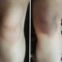 رفع سیاهی و تیرگی کل بدن
