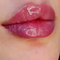 ژل وبوتاکس مواد کره‌ای اصل