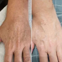 دفتر پخش کرم جوانه گندم (کلی و جزئی)