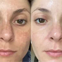 خدمات تخصصی پاکسازی و زیبایی صورت