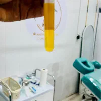 پی آر اف(بدون درد) پی آر پی و مزوتراپی