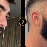 چرا ریشت کم پشت مونده