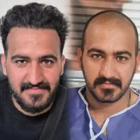 جشنواره عیدقربان‌کاشت موشیرازی ۱۰ میلیون فول تراکم