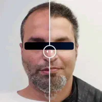 تیم کاشت حرفه ای از تهران برای اولین بار در مهاباد