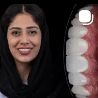 جشنواره عیدانه لبخند ماندگار با طرح عیدقربان