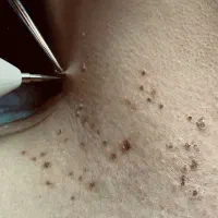 آموزش فیشال صفر تا صد به صورت حرفه ای