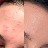 آموزش فشیال