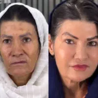 مدل زیبا وجوانسازی شفاف سازی لیف صورت به مدت محدود