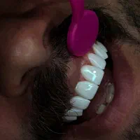تخفیف ویژه کامپوزیت بهاری