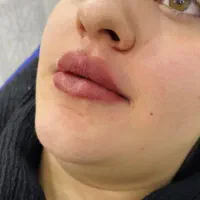 کلینیک زیبایی ژل فیلربادی نخ بوتاکس لیزرلاغری قسطی