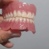 کشیدن دندان در محل