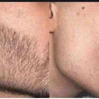 ریش هات مثل جنگل میشه