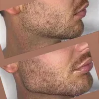 بوتاکس ژل ساکشن چربی جراحی بینی در کلینیک بهنود|خدمات آرایشگری و زیبایی|تبریز, |دیوار