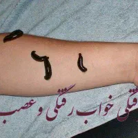زالو درمانی حجامت بادکش هرمشکلی داری تماس بگیرفقط