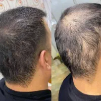 متخصص پوست و مو (درمان بدون بازگشت)