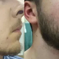 ریشاتو در میارم