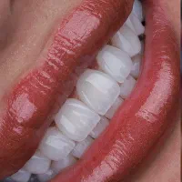 ارائه کلیه خدمات دنداپزشکی اقساط یک ساله کمالشهر